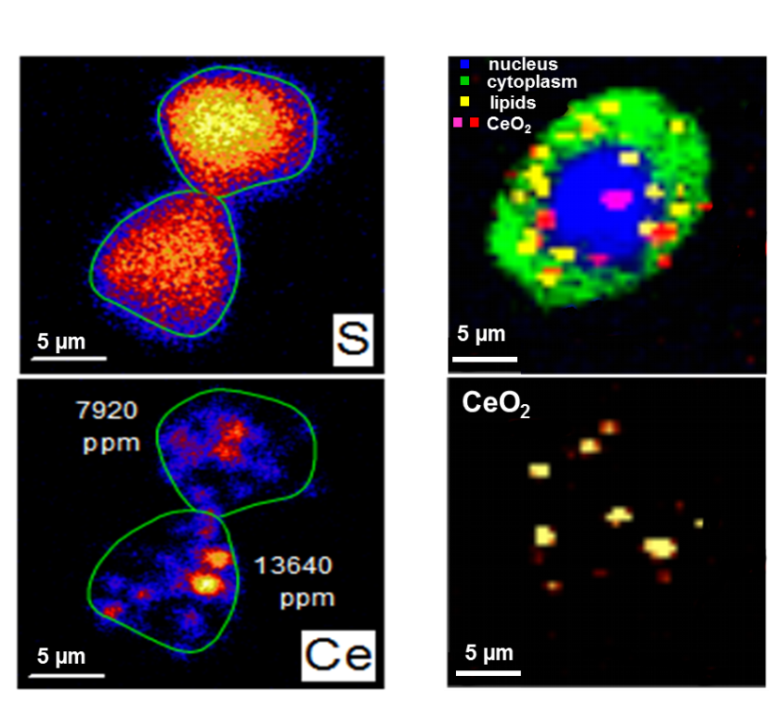 Labelfreie Visualisierung der Verteilung von CeO2 Nanopartikel in Lungenkrebszellen mittels element- (links) und molekülbasierenden (rechts) bildgebenden Verfahren. Mit der Ramanmikrospektroskopie ist es möglich, festzustellen, mit welchen Bausteinen der Zelle die Nanopartikel wechselwirken. Mit der Ionenstrahl-Mikroskopie kann die zelluläre Konzentration von Nanopartikel quantifiziert werden. © I. Estrela-Lopis & C. Merker / Universität Leipzig. Labelfreie Visualisierung der Verteilung von CeO2 Nanopartikel in Lungenkrebszellen mittels element- (links) und molekülbasierenden (rechts) bildgebenden Verfahren. Mit der Ramanmikrospektroskopie ist es möglich, festzustellen, mit welchen Bausteinen der Zelle die Nanopartikel wechselwirken. Mit der Ionenstrahl-Mikroskopie kann die zelluläre Konzentration von Nanopartikel quantifiziert werden. © I. Estrela-Lopis & C. Merker / Universität Leipzig.